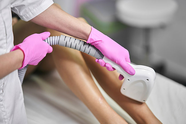 epilare definitiva cu laser